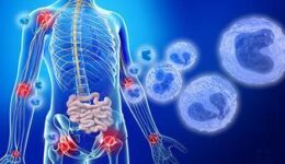 A digital illustration showing the human body with highlighted areas of inflammation, suggesting rheumatoid arthritis and other inflammatory diseases affecting joints and organs.