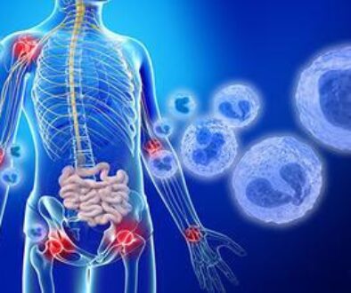 A digital illustration showing the human body with highlighted areas of inflammation, suggesting rheumatoid arthritis and other inflammatory diseases affecting joints and organs.